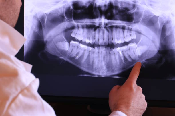 Best Broken or Chipped Tooth Repair in Gratton, VA