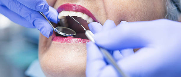 Best Emergency Cosmetic Dentistry (e.g., broken veneers) in Gratton, VA